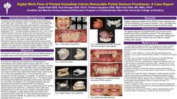 Thumbnail for <p>Digital Work Flow of Printed Immediate Interim Removable Partial Denture Prosthesis - A Case Report </p> 
<p> </p>
