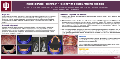 Preview of Implant Surgical Planning in a Patient with Severely Atrophic Mandible