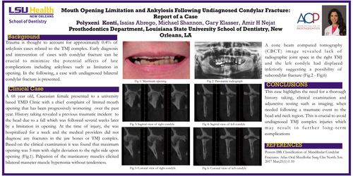 Preview of Mouth Opening Limitation and Ankylosis Following Undiagnosed Condylar Fracture: Report of a Case