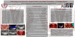 Thumbnail for Fabrication of a floating implant and bone surgical guide using digital technology: A technique article 