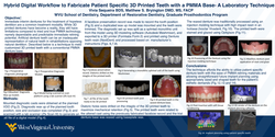 Thumbnail for Hybrid Digital Workflow to Fabricate Patient Specific 3D Printed Teeth with a PMMA Base - A laboratory technique.