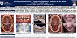 Thumbnail for Full mouth rehabilitation of an 18-years-old patient with amelogenesis imperfecta: A case report