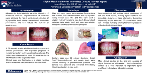 Preview of Digital Maxillary Interim Immediate Denture- A case report