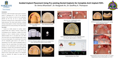 Preview of Fully Guided Implant Placement Using Pre-existing Dental Implants for Full Arch Implant FDPs