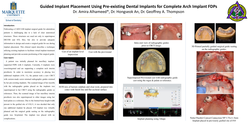 Thumbnail for Fully Guided Implant Placement Using Pre-existing Dental Implants for Full Arch Implant FDPs