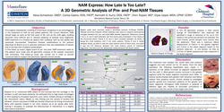 Thumbnail for NAM Express: How Late is Too Late? A 3D Geometric Analysis of Pre- and Post- NAM Alveolar Tissues. 