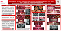 Thumbnail for Multidisciplinary full mouth rehabilitation for a patient with Dentinogenesis Imperfecta 