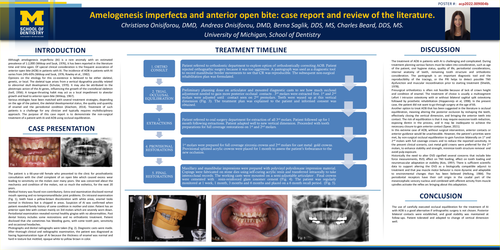 Preview of Amelogenesis imperfecta and anterior open bite: case report and review of the literature.