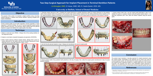 Preview of Two-Step Surgical Approach for Implant Placement in Terminal Dentition Patients