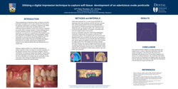 Thumbnail for “Utilizing a digital impression technique to capture soft tissue development of an edentulous ovate pontic site”