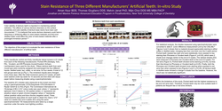Thumbnail for Stain Resistance of Three Different Manufacturers’ Artificial Teeth: In-vitro Study
