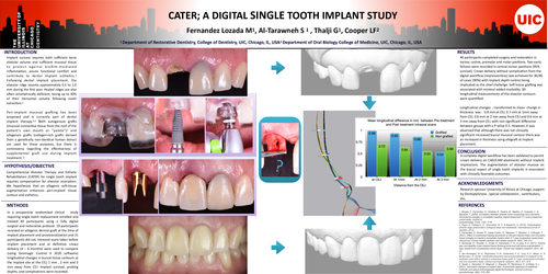 Preview of CATER; A DIGITAL SINGLE TOOTH IMPLANT STUDY