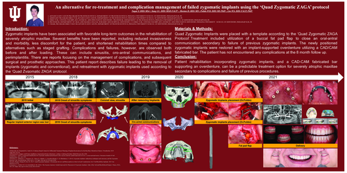 Preview of An alternative for re-treatment and complication management of failed zygomatic implants using the ‘Quad Zygomatic ZAGA’ protocol