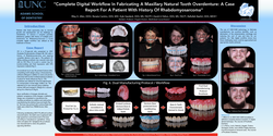 Thumbnail for “Complete Digital Workflow in Fabricating Maxillary Tooth-borne Overdenture: A Case Report for a Patient with History of Rhabdomyosarcoma”