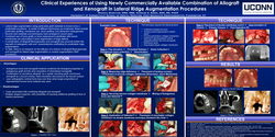 Thumbnail for Clinical experiences of using newly commercially available combination of allograft and xenograft in lateral ridge augmentation procedures