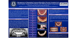 Thumbnail for Management of a Repeatedly Fractured Monolithic Zirconia Complete Arch Fixed Implant-Supported Prosthesis with Differing Implant Components