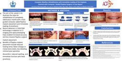 Thumbnail for <sub>Complete Maxillary Rehabilitation with Immediate Loading of the Implants inserted with Computer Guided Flapless Surgery: A Case Report</sub>