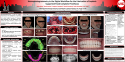 Thumbnail for Stereophotogrammetry in the Digital Workflow for the Fabrication of Implant-supported Fixed Complete Prostheses