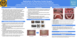 Thumbnail for “Applications of sleeveless guided surgery”