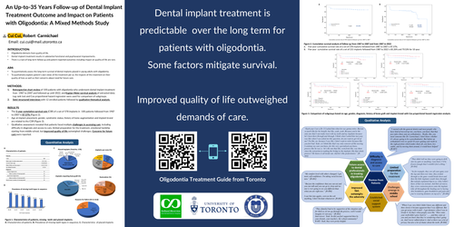 Preview of An Up-to-35 Years Follow-up of Dental Implant Treatment Outcome and Impact on Patients with Oligodontia: A Mixed Methods Study