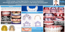 Preview of S.T.A.R. concept : A novel digital workflow for full arch rehabilitation with complete dental implant fixed prosthesis in a high esthetic demanding patient.