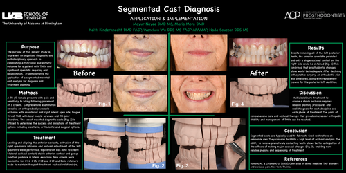 Preview of Segmented Cast Diagnosis: Application and Implementation