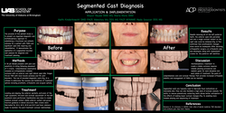 Preview of Segmented Cast Diagnosis: Application and Implementation 