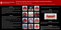 Thumbnail for Thermoplastic overdenture trays for immediate interim fixed prosthesis.