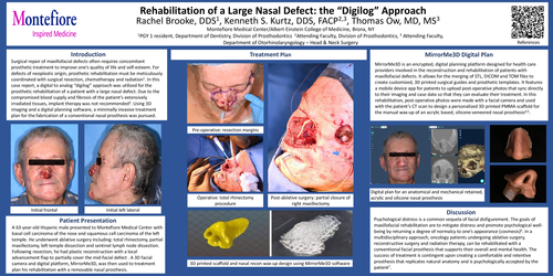 Preview of Maxillofacial Treatment Plan for the Rehabilitation of a Large Nasal Defect