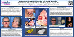 Thumbnail for Maxillofacial Treatment Plan for the Rehabilitation of a Large Nasal Defect