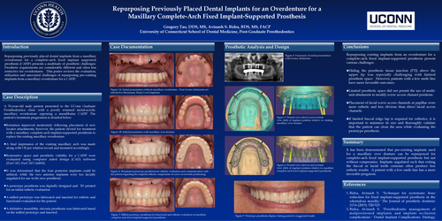 Preview of Simplified Digital and Conventional Workflow for Production of Prototype Complete Arch Fixed Implant-Supported Prosthesis