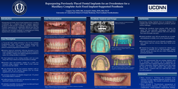Thumbnail for Simplified Digital and Conventional Workflow for Production of Prototype Complete Arch Fixed Implant-Supported Prosthesis