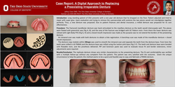 Thumbnail for A digital approach to replacing a preexisting irreparable denture