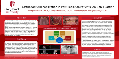 Preview of Prosthodontic Rehabilitation in Post-Radiation Patients: An Uphill Battle?