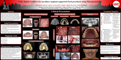 Thumbnail for Fully digital workflow in treatment planning for maxillary implant-supported fixed prosthesis with Photogrammetry 