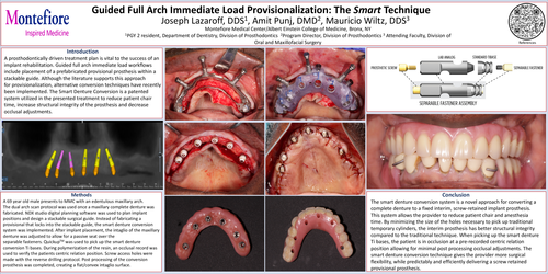 Preview of Guided Full Arch Immediate Load Provisionalization: The Smart Technique
