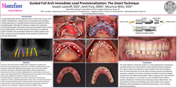 Thumbnail for Guided Full Arch Immediate Load Provisionalization: The Smart Technique