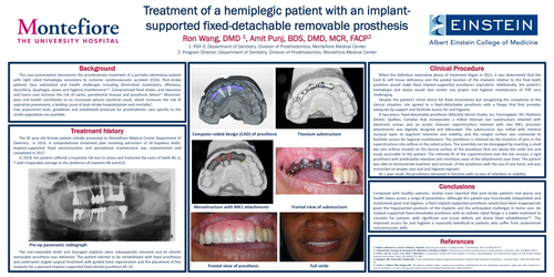 Preview of Treatment of a hemiplegic patient with implant-supported rigid removable prosthesis