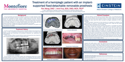 Thumbnail for Treatment of a hemiplegic patient with implant-supported rigid removable prosthesis