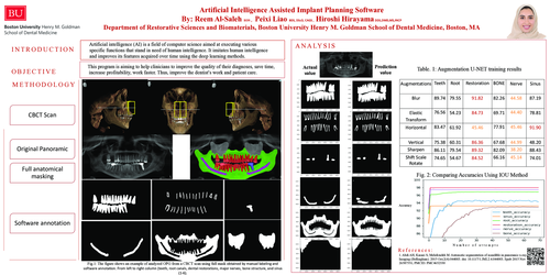 Preview of Artificial intelligence assisted implant planning software