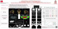 Thumbnail for Artificial intelligence assisted implant planning software