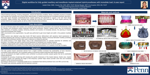 Preview of Digital workflow for fully guided maxillary and mandibular implant-retained hybrid prostheses with immediate placement and immediate load: A case report