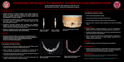 Thumbnail for Anodizing Technique to Improve Esthetics 