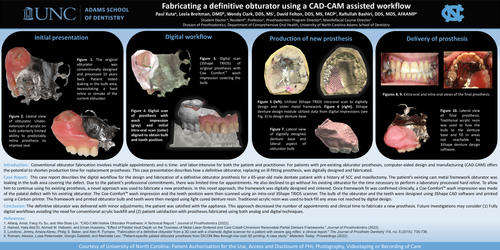 Preview of Fabricating a definitive obturator using a CAD-CAM assisted workflow