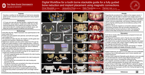Preview of Digital Workflow for a tooth borne Stackable guide for a fully guided bone reduction and implant placement using magnetic connections.