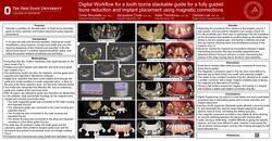 Thumbnail for Digital Workflow for a tooth borne Stackable guide for a fully guided bone reduction and implant placement using magnetic connections.
