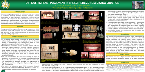 Preview of <p>Difficult implant placement in the esthetic zone: a digital solution</p> <p> </p>