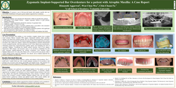 Thumbnail for Zygomatic Implant Supported Bar Overdenture for a patient with Atrophic Maxilla: A Case Report