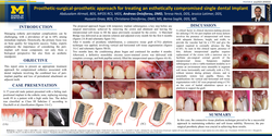 Thumbnail for Prosthetic-surgical-prosthetic approach for treating esthetically compromised single dental implant