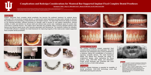 Preview of <p>Complications and Redesign Considerations for Montreal Bar-Supported Implant Fixed Complete Dental Prostheses</p>
<p> </p>